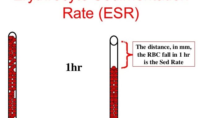 esr-test-explanation-normal-values-high-and-low-mean-procedure-youtube